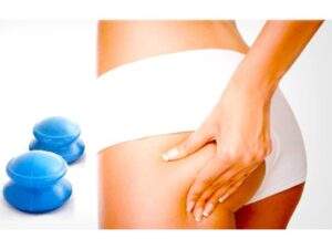 Jędrne i kształtne pośladki po masażu bańką chińską.