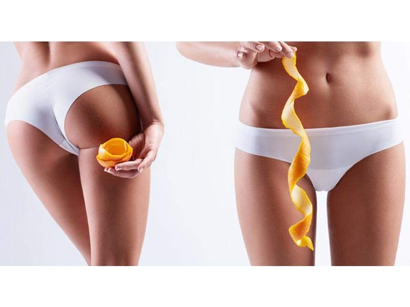 Skuteczne metody walki ze skórką pomarańczy, czyli antycellulitowe działanie masażu bańką chińską.