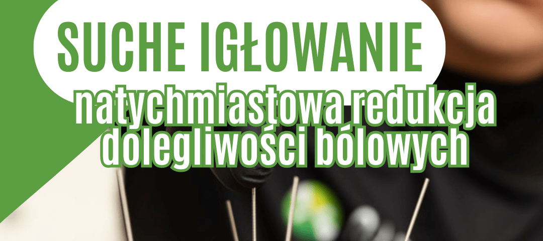 igłowanie