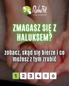 haluksy leczenie zachowawcze