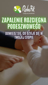 zapalenie rozcięgna podeszwowego