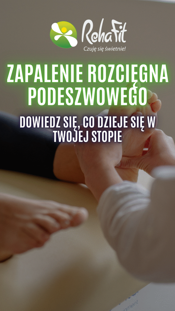 zapalenie rozcięgna podeszwowego
