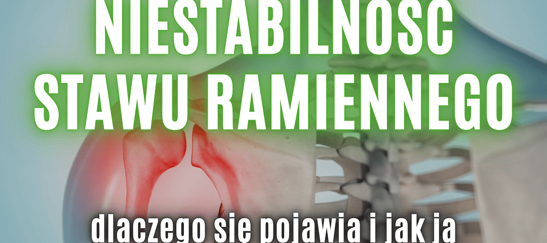 niestabilność stawu ramiennego