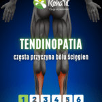 tendinopatia