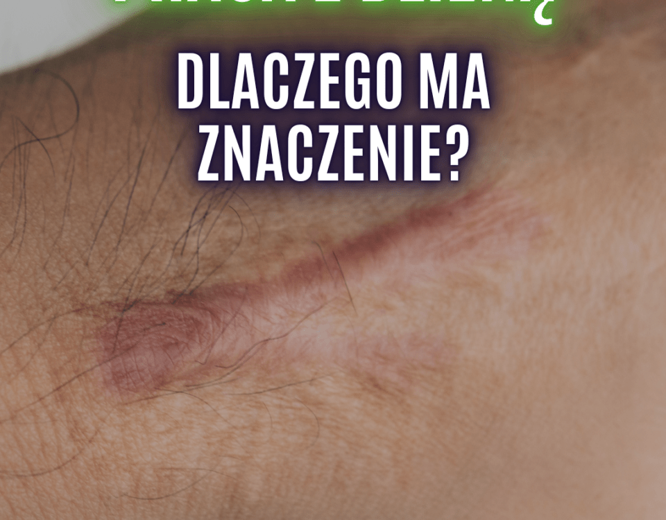 praca z blizną